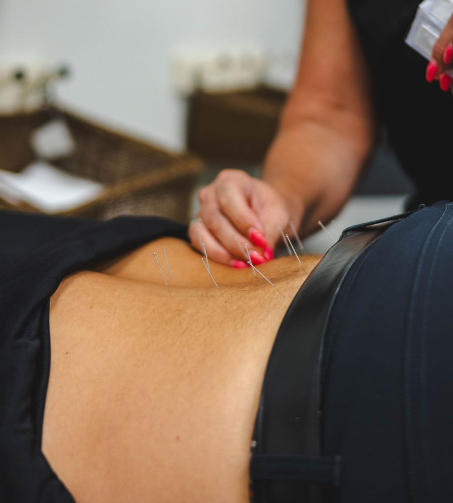 Service: Acupuncture | Lakewood Ranch, Sarasota, Parrish, Palmetto